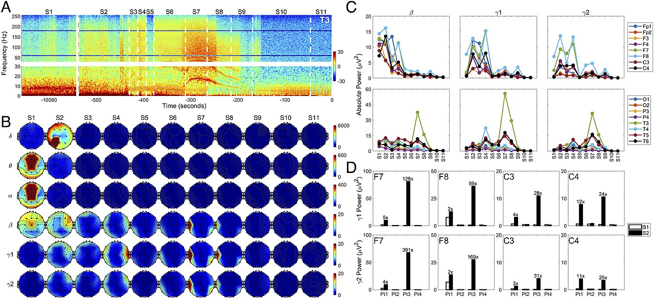 human brain waves EEG monitor scientific medical